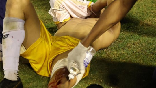 Scene horror într-un meci din campionatul Braziliei! Un fotbalist a fost împușcat în picior de un polițist