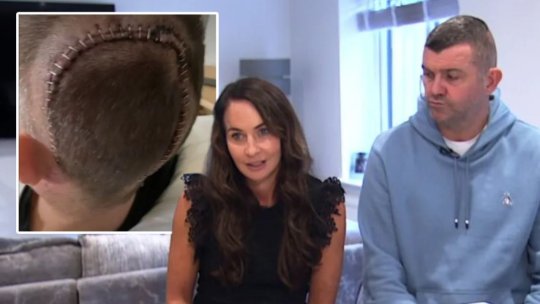 Experiența teribilă prin care a trecut Dominic Matteo, fostul star de la Liverpool sau Leeds! A jucat toată cariera cu o tumoare pe creier: "Încă pare incredibil!"