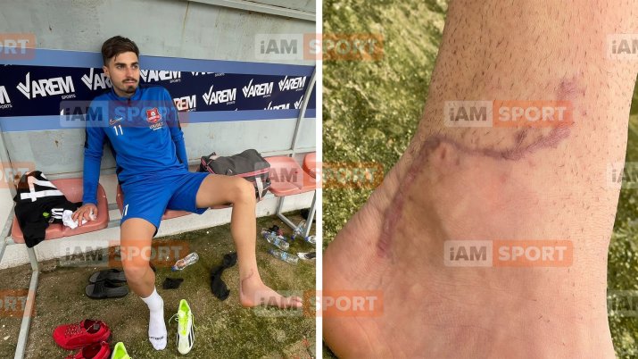 Cicatricea după una dintre operațiile la care a fost supus Dragoș Iancu