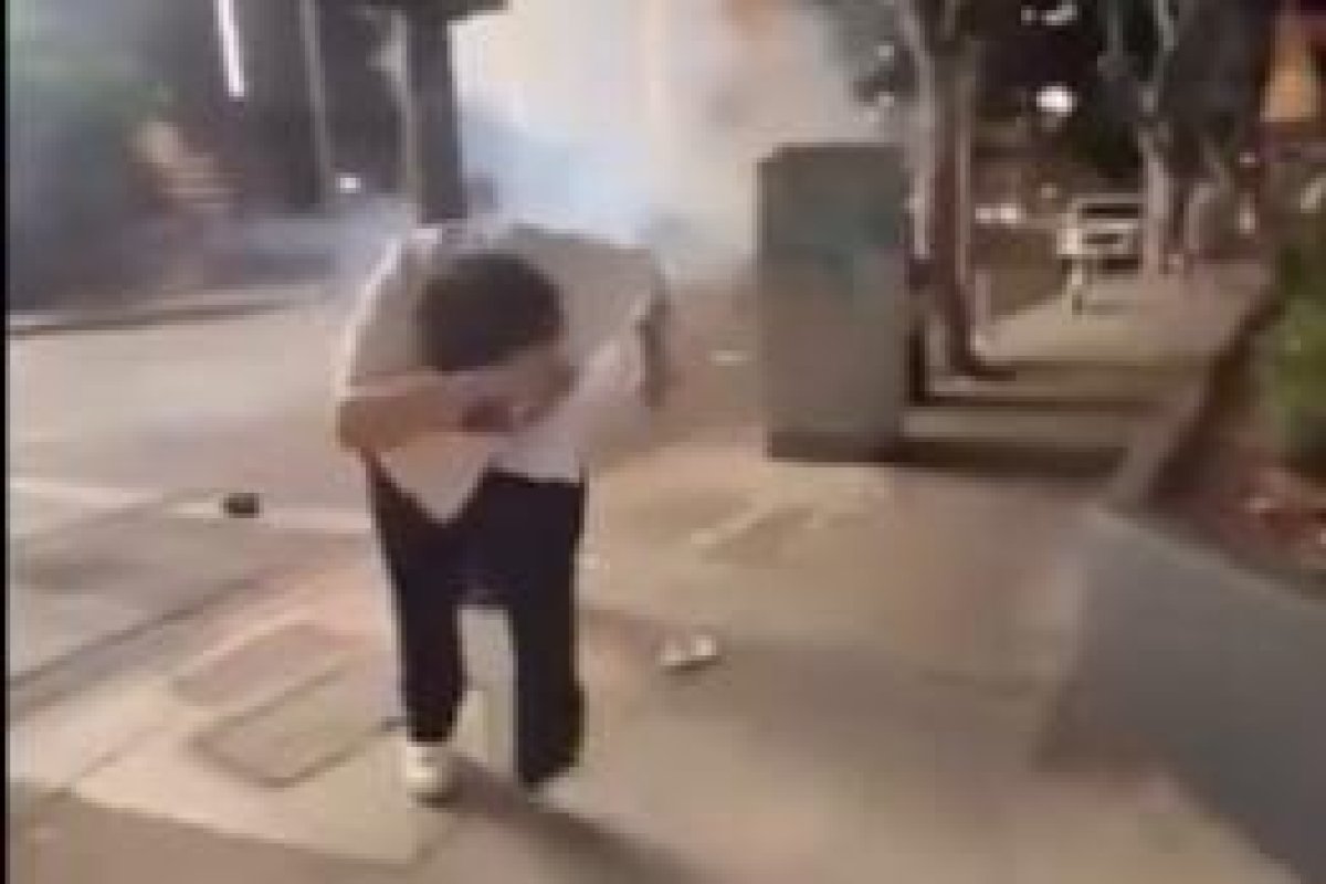 Un fan și-a distrus mâna după ce artificiile i-au explodat neașteptat când le avea în palmă