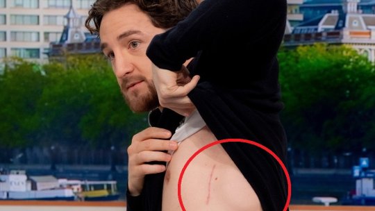 Tom Lockyer spune că a fost mort timp de aproape 3 minute. Ce-și amintește despre momentul în care s-a trezit. FOTO | Imagini greu de privit