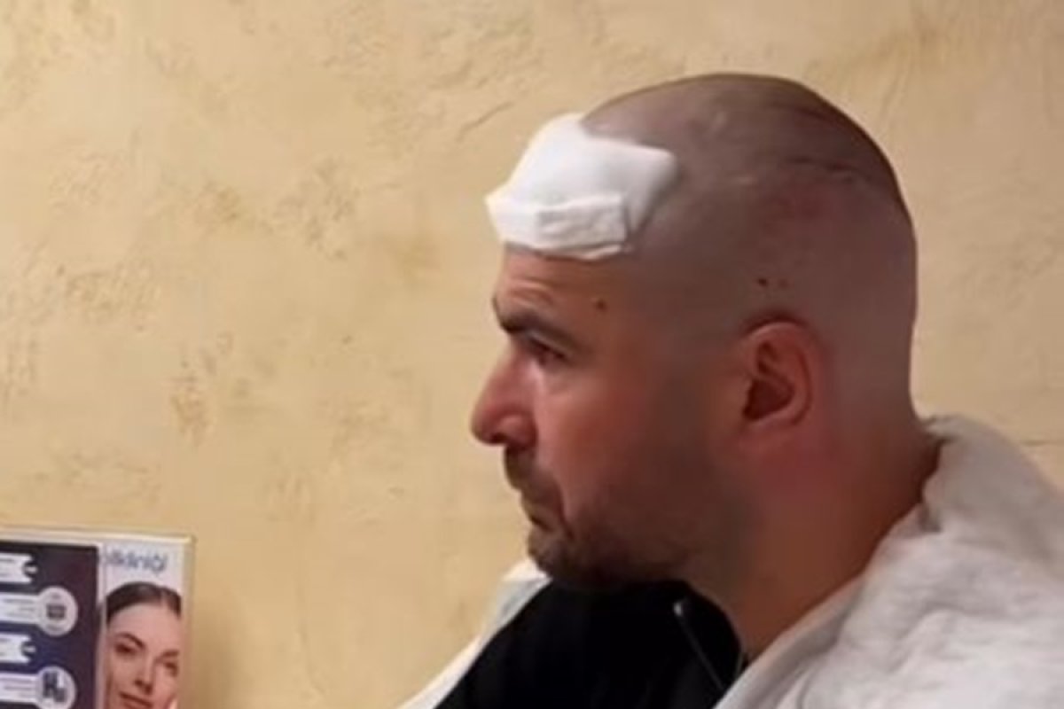 Adi Mutu și-a făcut implant de păr