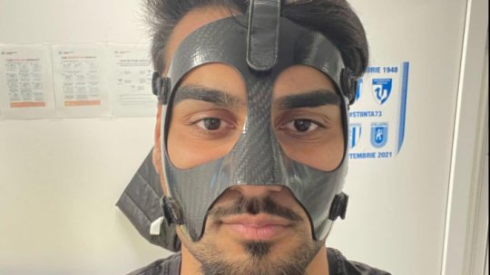 Ștefan Baiaram a primit verdictul. Cât va juca cu mască după ciocnirea cu Alex Albu