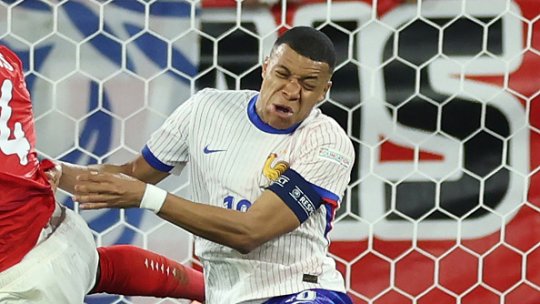 S-a terminat Euro pentru Mbappe? Starul Franței a părăsit terenul în sânge, după ce și-a rupt nasul. Imagini șocante cu noul ”galactic”
