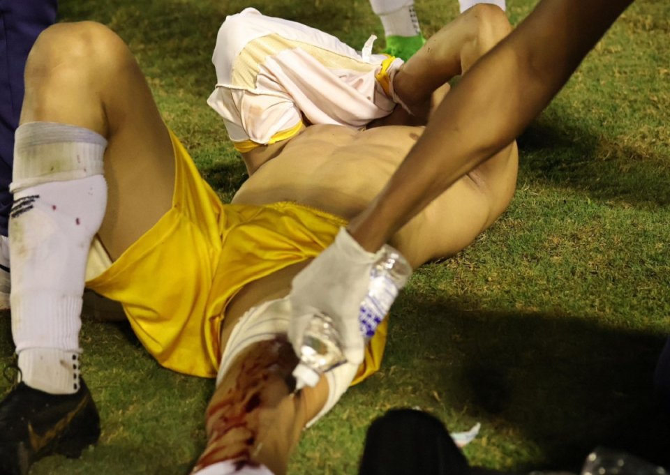 Imagini cu piciorul fotbalistului Ramon Souza