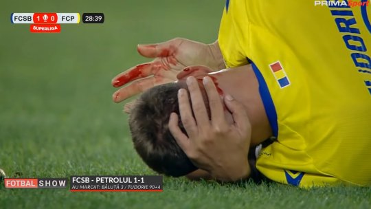 Trebuia eliminat Mihai Popescu în FCSB - Petrolul? Ce spun specialiștii: ”Din moment ce apare sânge...” / ”Cea a lui Jyry e de 5 ori mai gravă!”