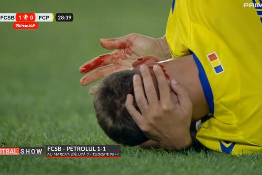 Trebuia eliminat Mihai Popescu în FCSB - Petrolul? Ce spun specialiștii: ”Din moment ce apare sânge...” / ”Cea a lui Jyry e de 5 ori mai gravă!”