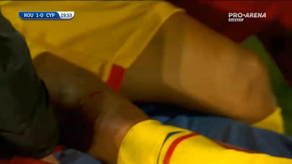 Ce accidentare gravă riscă Musi dacă va juca cu Rapid. Decizia fotbalistului