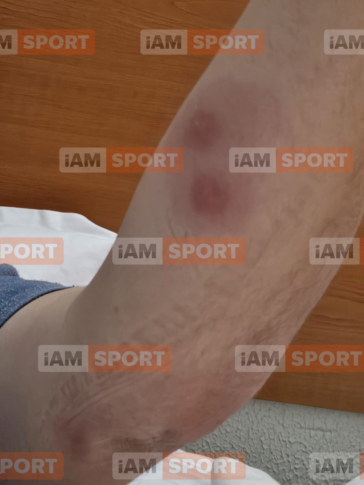 Parinte ciupit de plosnite