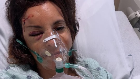 O prezentatoare TV a suferit un accident îngrozitor și nu-și mai aduce nimic aminte: ”Este tot ce vă pot spune”