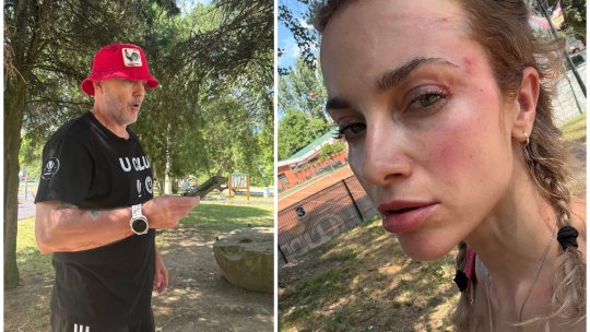 O femeie a fost snopită în bătaie de un fan U Cluj în parc: ”Mi-a spus că sunt ucraineancă și că nu am niciun drept să fiu aici”