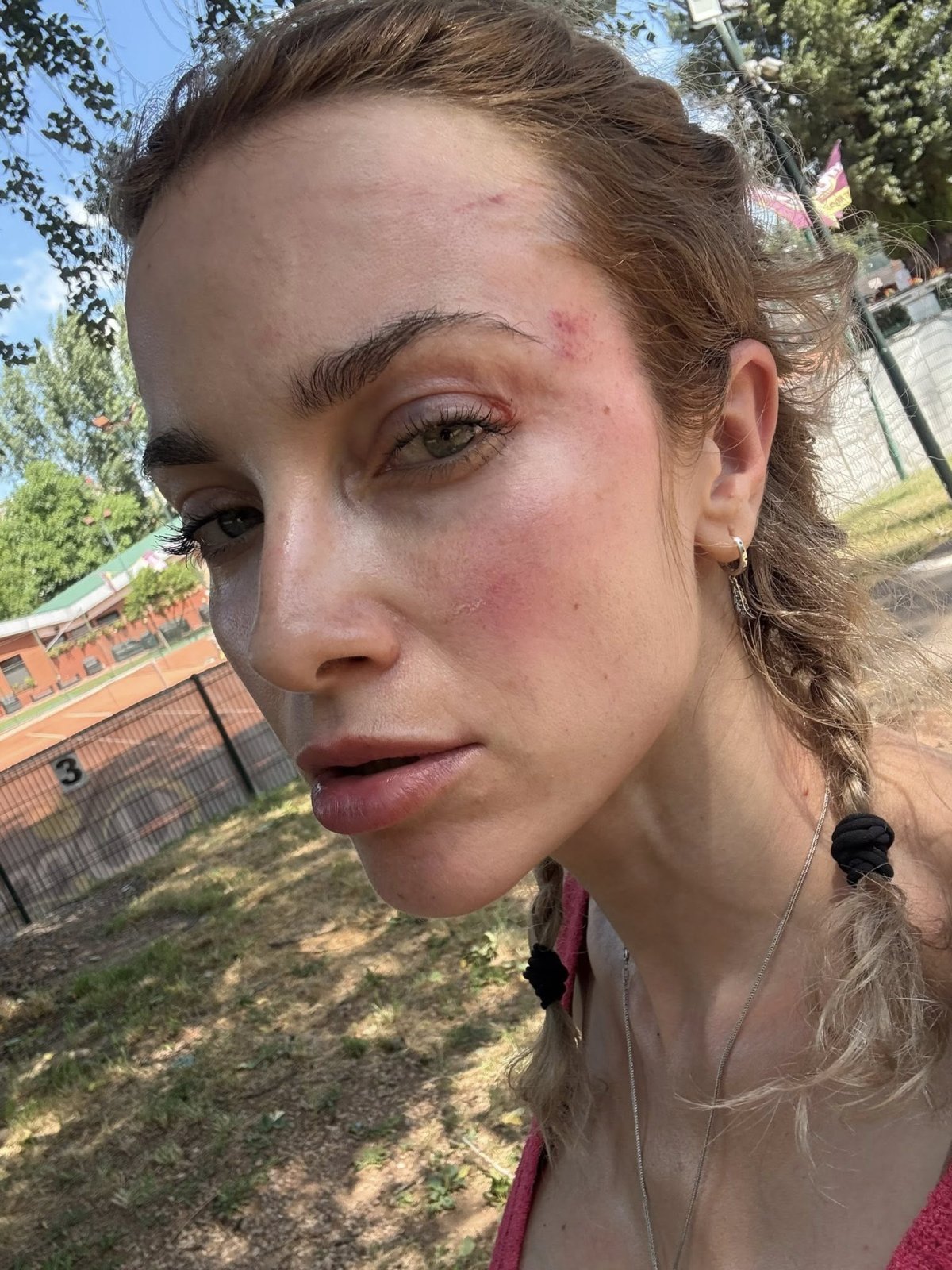 Foto 4/18