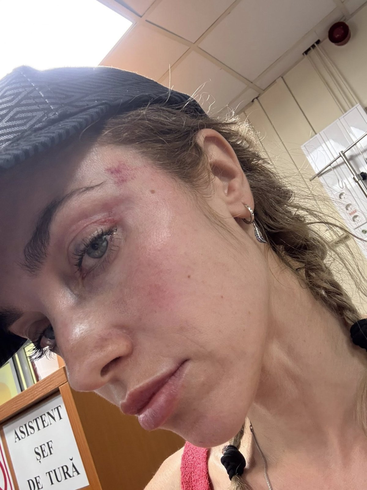 Siuko Siu, femeia agresată în parcul din Cluj