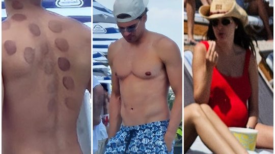 Ianis Hagi, cu urme ciudate pe spate. În așteptarea unui contract, mijlocașul a mers împreună cu Elena să se relaxeze