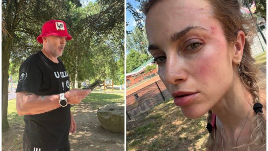 Omul acuzat că a agresat o femeie în parc se apără: ”E fostă practicantă de sporturi de contact. A lovit 2 minori și a fost nevoie să intervină 3 bărbați pentru a opri agresiunile ei”