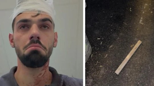 Doi jucători de la Poli Timișoara l-au bătut cu parul și l-au băgat în spital pe fiul unui fost fotbalist! Dan Alexa a anunțat decizia clubului după incidentul șocant