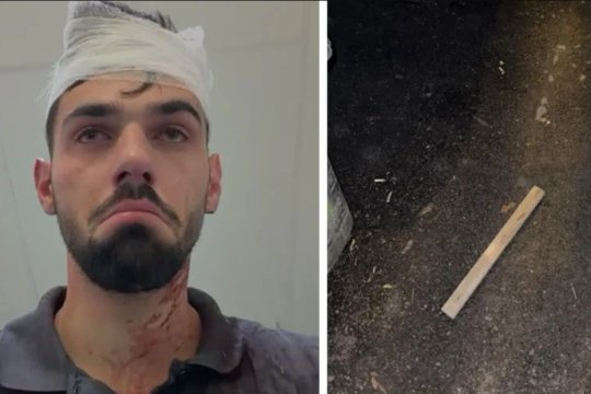 Doi jucători de la Poli Timișoara l-au bătut cu parul și l-au băgat în spital pe fiul unui fost fotbalist! Dan Alexa a anunțat decizia clubului după incidentul șocant