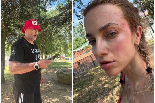 O femeie a fost snopită în bătaie de un fan U Cluj în parc: ”Mi-a spus că sunt ucraineancă și că nu am niciun drept să fiu aici”